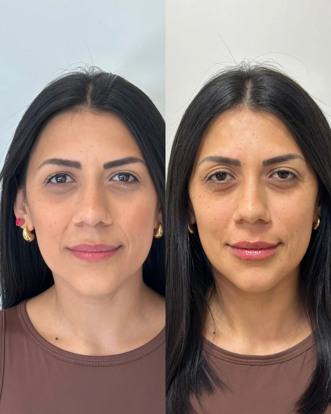 Registro autorizado de atendimento em harmonização facial