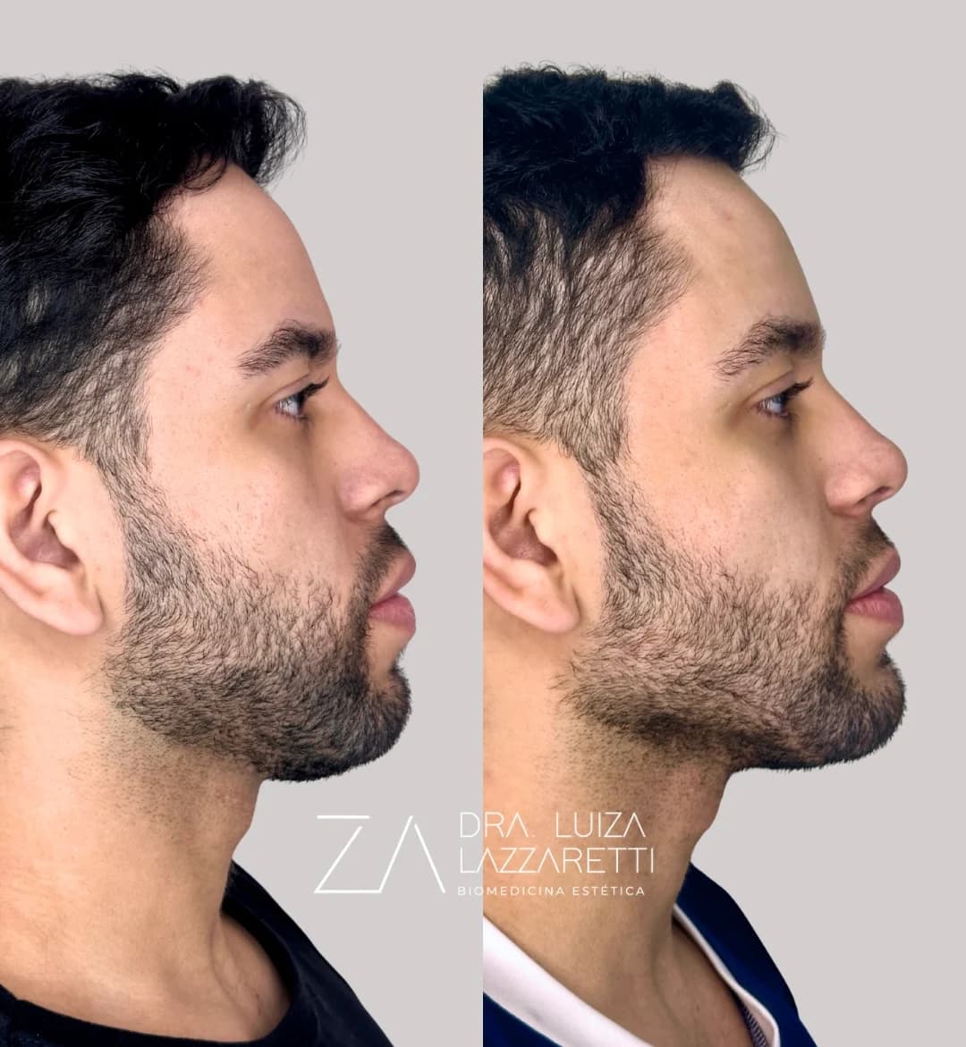 Registro autorizado de harmonização facial masculina