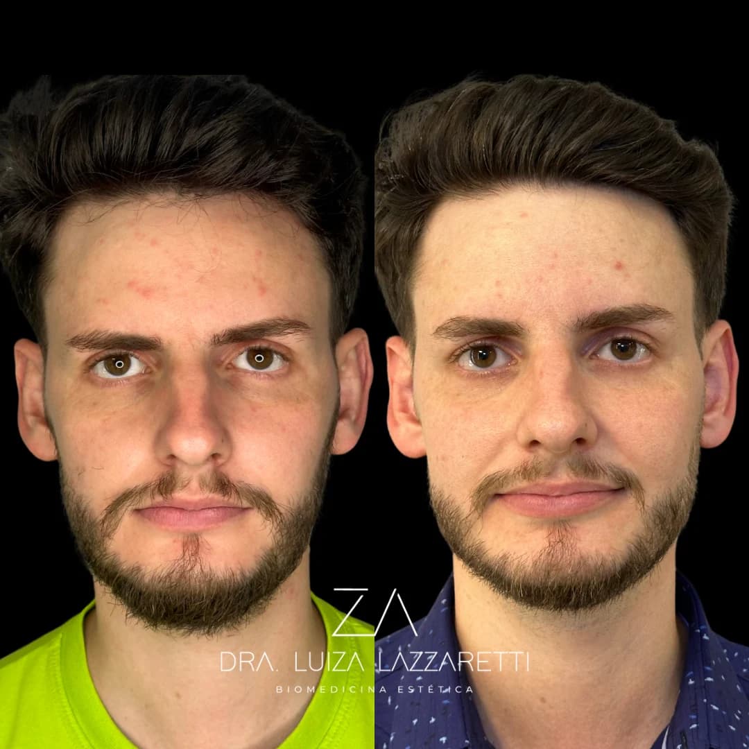 Paciente em planejamento de harmonização facial masculina