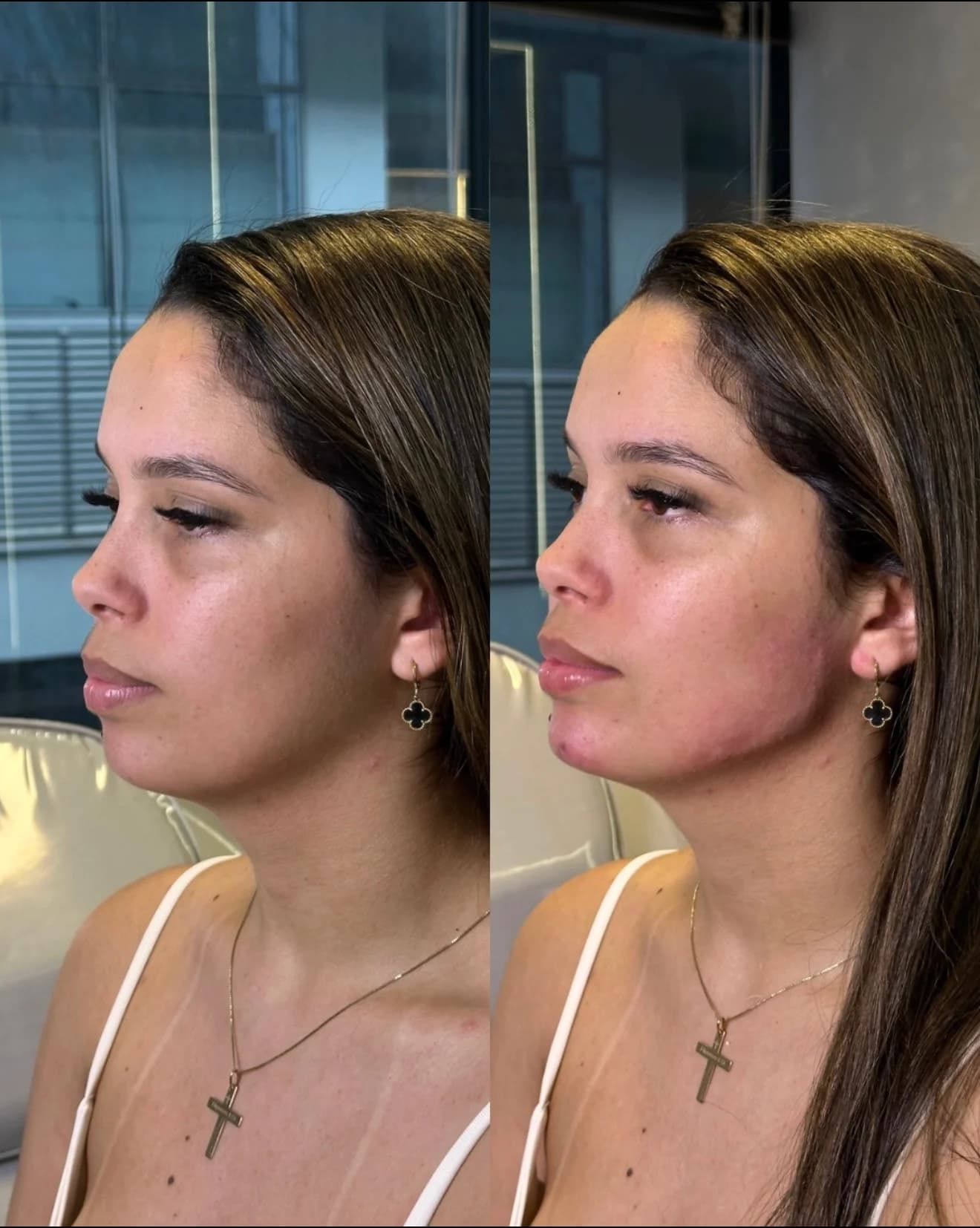 Registro autorizado de planejamento com preenchimentos faciais