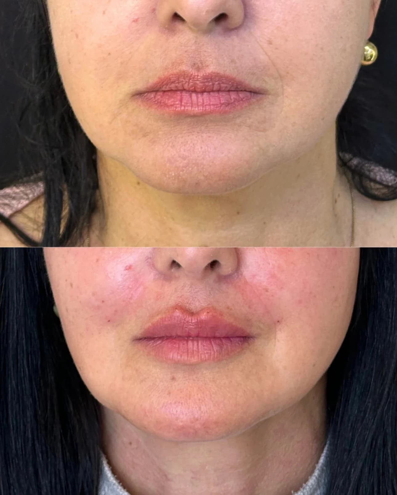 Paciente em planejamento de rejuvenescimento facial