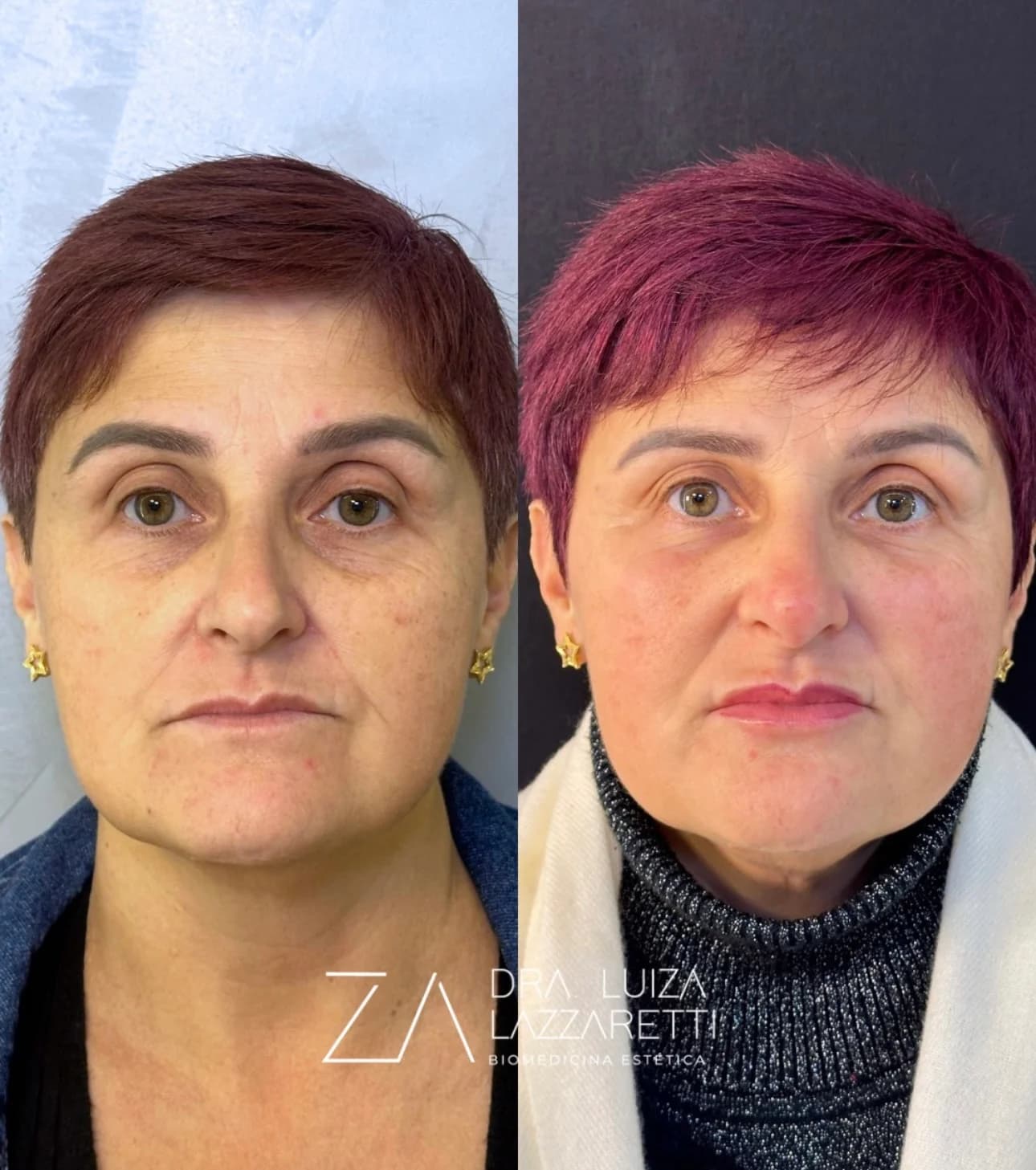 Planejamento de rejuvenescimento facial com abordagem natural